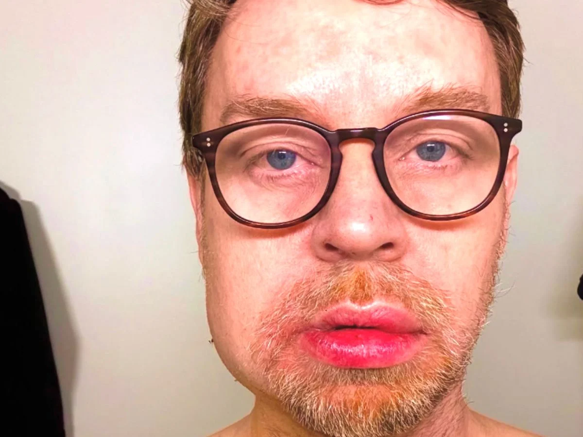 Savage Garden的Darren Hayes詳細說明了威脅生命的傷害：“我可能死了”